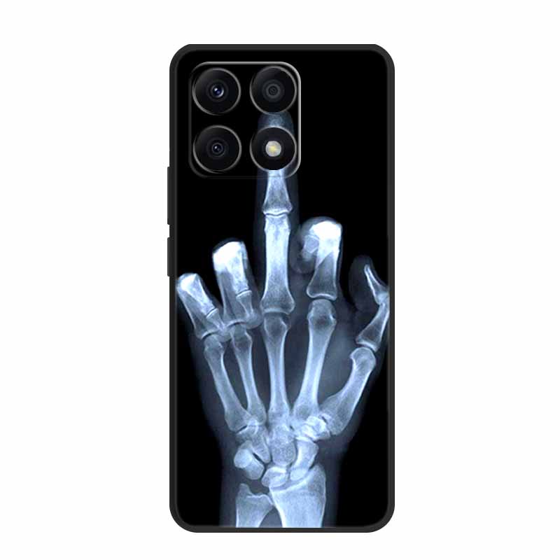For Xiaomi 14T Pro Case 14 T Pro Phone Cover Lion Wolf Black Silicone Soft Back Cover Cases For Xiaomi 14T Pro Case 14TPro Funda