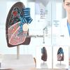 Human Pathological Lung Anatomy Model - Respiratory System