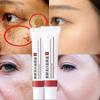 Whitening Freckle Cream Effektiv Fjern mørke flekker Anti Freckle Cream Fade Pigmentation Melasma Brighten Cream