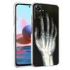 Transparent Phone Case for Redmi 14C 13C 10C 10 9 Note 13 12 11 K50 K40 Plus Pro 4G 5G Soft TPU Cover Autumu X Ray Hand Bones
