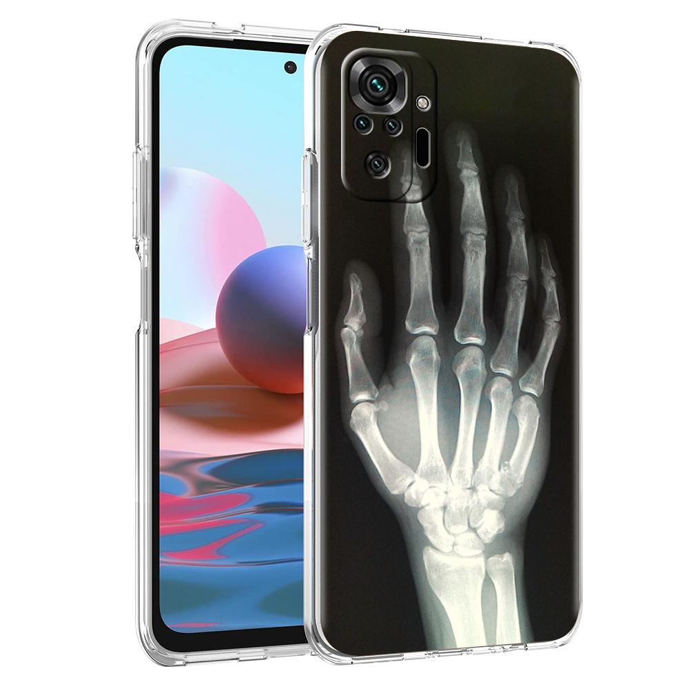 Transparent Phone Case for Redmi 14C 13C 10C 10 9 Note 13 12 11 K50 K40 Plus Pro 4G 5G Soft TPU Cover Autumu X Ray Hand Bones