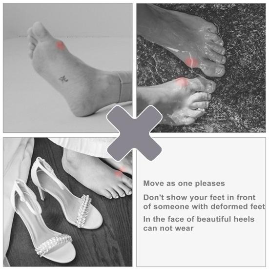 Zehen-Korrekturhülsen, Bunion-Korrektor, verstellbar, flexibel, atmungsaktiv, nicht reizend, Schmerzlinderung, postoperative Erholung, orthopädische Bunion-Schiene, groß