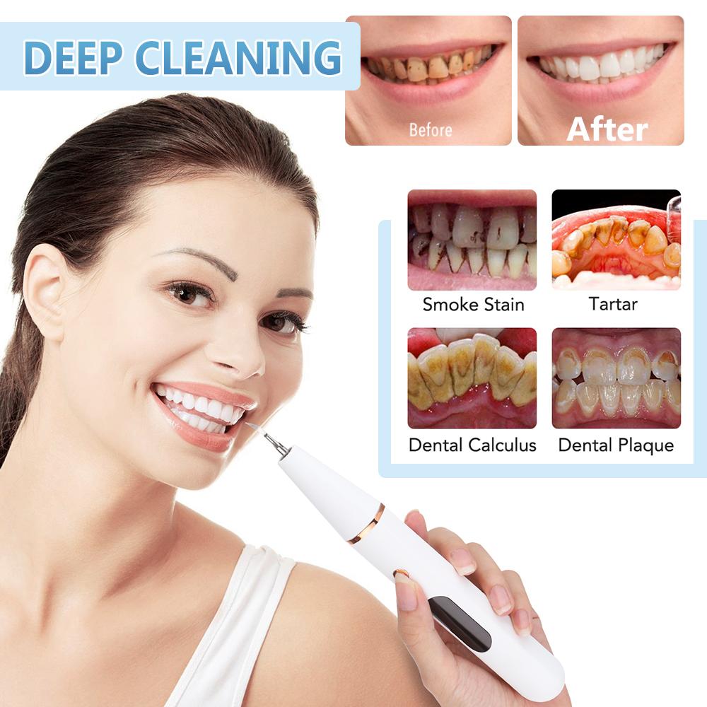 Ultrasonic Dental Scaler Tooth Cleaner Smoke Stains Plaque Calculus Tartar Removal Teeth Cleaning Whitening Oral Care Tools