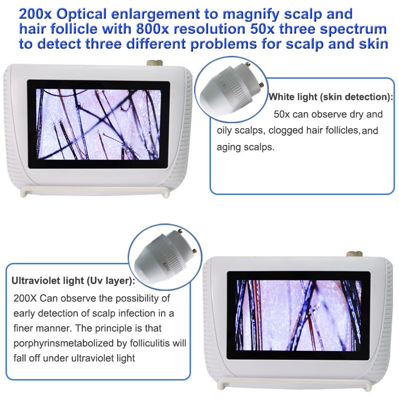 Scalp Hair Follicle Detection Analyzer All-In-One Skin Diagnosis Hair Analyzer High-Definition LCD Screen Digital Home