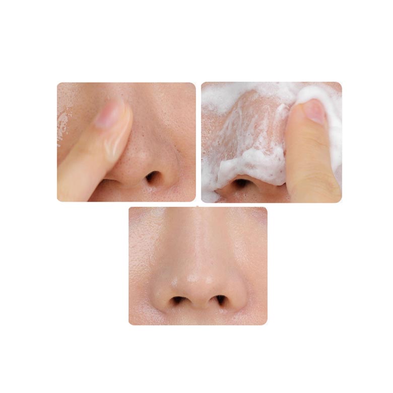 MEDI-PEEL Limpador Extra Super 9+ Pore Tox 120ml