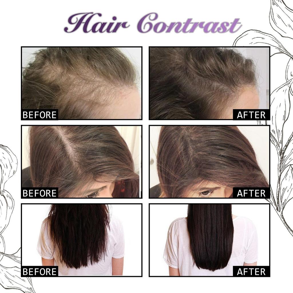 EELHOE Onion Rosemary Hair Spray Deep Moisturizing Scalp Smooth & Shine Hair Conditioning Spray