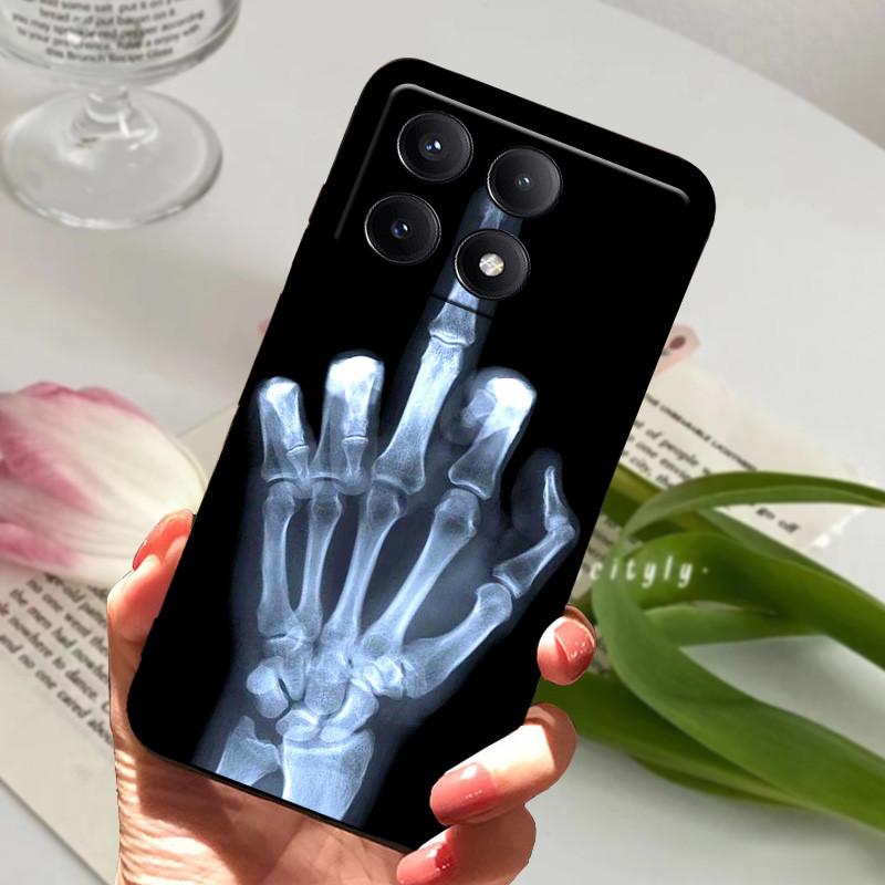 POCO X6 Pro 5G tokhoz POCOX6 Ütésálló Puha TPU Szilikon Telefonfedél Xiaomi POCO X6 Pro 5G-hez Capa Rajzfilm Matt Ütésvédő