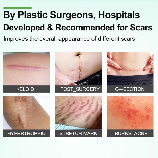 Silicone Scar Sheets Scar Tape Roll Professional Soft Scar Strips for Surgical Scars Keloids Acne Scar Treatment Silicone Gel Patch