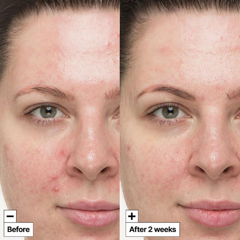 Dr.Jart Cicapair™ Tratamento Soothing 30mL (3 Opções)
