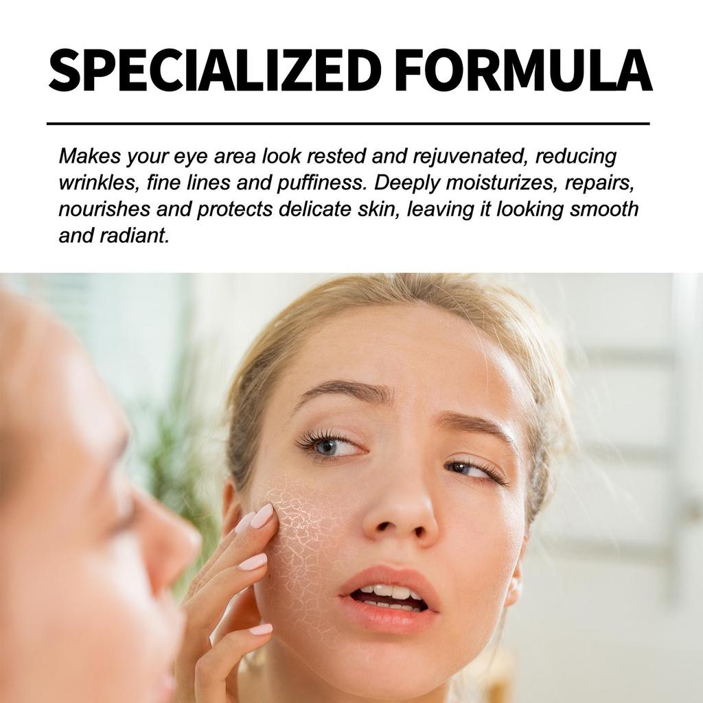 Jaysuing Eye Gel - Nourishing and Moisturizing, Firms Skin, Reduces Fine Lines and Dark Spots, Brightens Skin, Women's Gifts