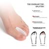 SEBS Big Toe Bunion Corrector and Hallux Valgus Straightener for Overlapping Toes
