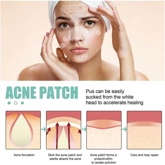 132Pcs/Pack Acne Pimple Patches Ultra-Thin Invisible Acne Removal Patches Covering Blemishes Zit Patches Face Acne Treatment Spot Zit Stickers