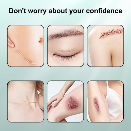 Silicone Scar Sheets Scar Tape Roll Professional Soft Scar Strips for Surgical Scars Keloids Acne Scar Treatment Silicone Gel Patch