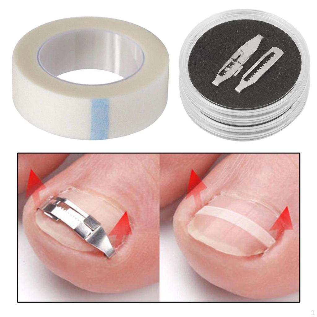 Carbon Steel Ingrown Toenail Treatment Correcting Tool