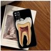Human Tooth Anatomy Case For Xiaomi Redmi Note 13 11 10 9 8 12 Pro Plus 12S 11S 10S 9S 10A 9C 10C 12C 13C Funda