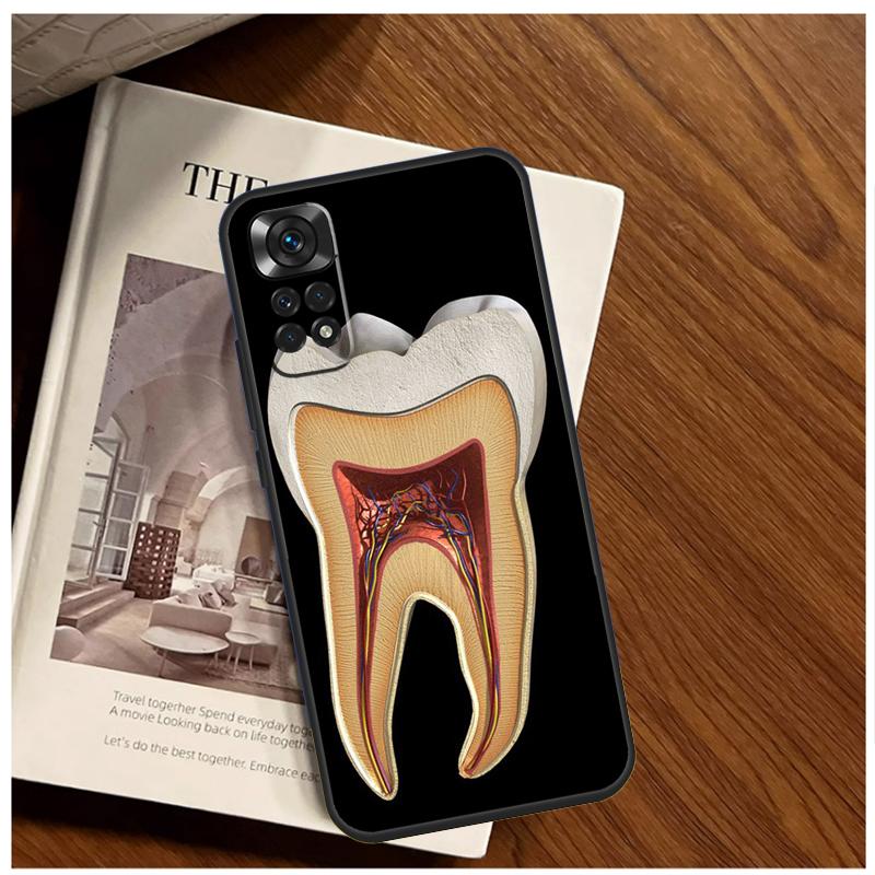 Human Tooth Anatomy Case For Xiaomi Redmi Note 13 11 10 9 8 12 Pro Plus 12S 11S 10S 9S 10A 9C 10C 12C 13C Funda