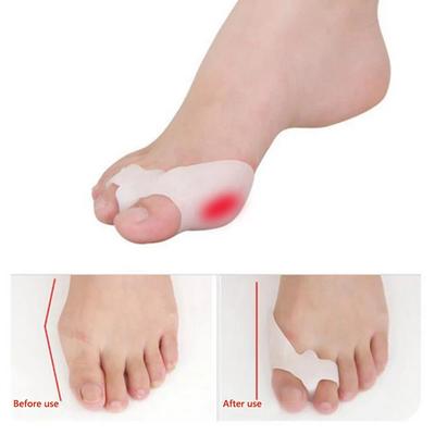 Silicone Gel Foot Toes Two Hole Toe Separator Thumb Valgus Protector Bunion Hallux Valgus Guard Feet Overlapping Pad Insert 2Pcs