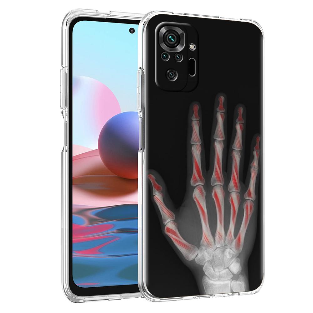 Transparent Phone Case for Redmi 14C 13C 10C 10 9 Note 13 12 11 K50 K40 Plus Pro 4G 5G Soft TPU Cover Autumu X Ray Hand Bones