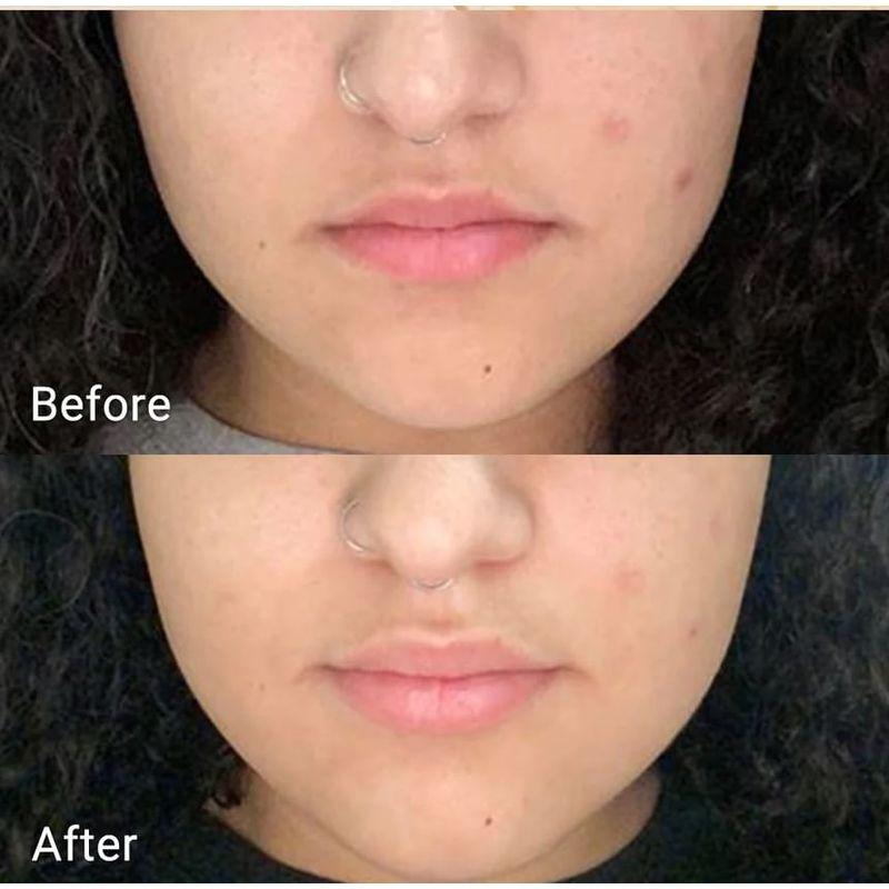 APRILSKIN - Real Calendula Peel Off Pack Bundle Set