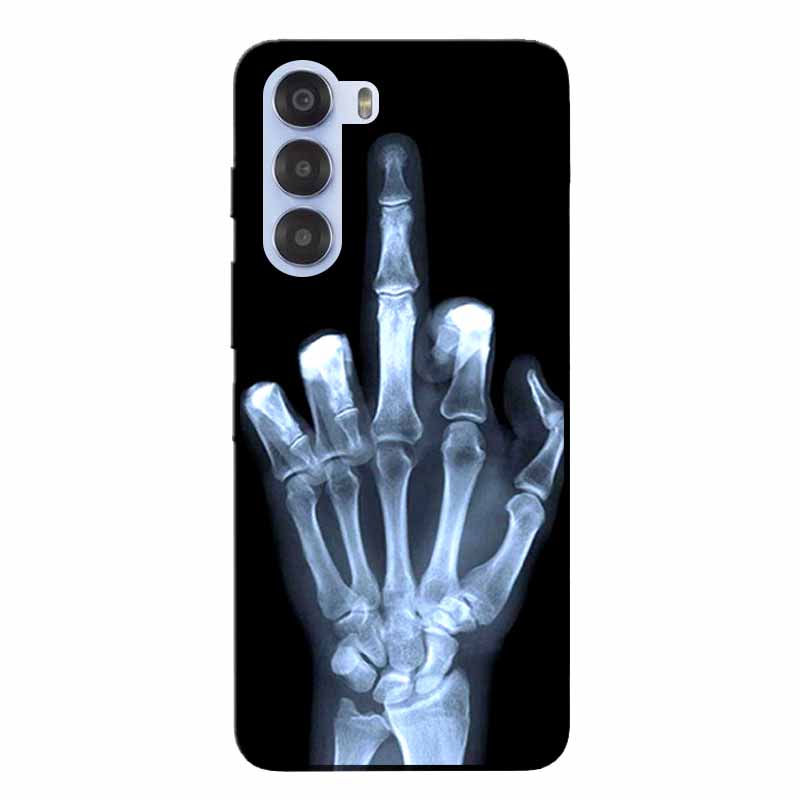 For ZTE Nubia S 5G A403ZT Case Soft Black Silicone Back Cover For Nubia S 5G Protective Shockproof TPU Funda A403ZT Phone Cases