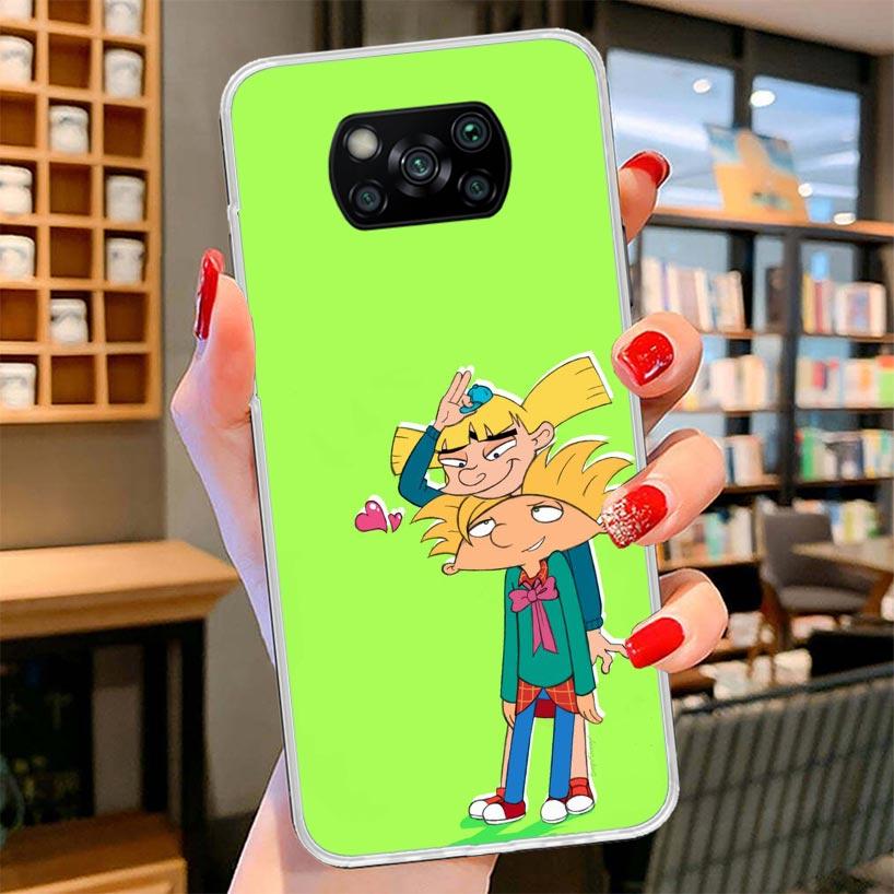 Cartoon Hey Arnold Fondos Cover Phone Case For Xiaomi Poco F7 Ultra X7 X6 X5 Pro M7 Redmi 15C 15 13C 13 12C 12 10C 10 9A 9C 9T 9
