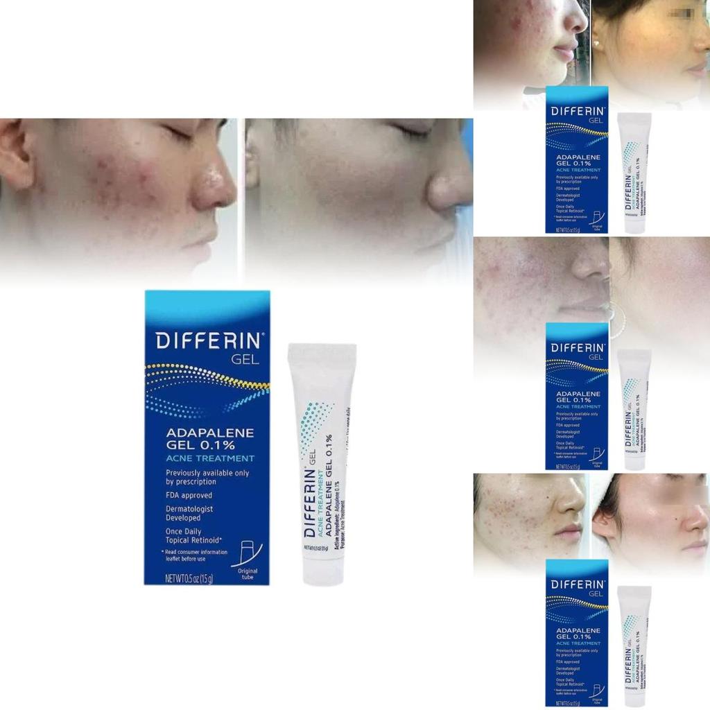 Differin Acne Treatment Gel Retinoid Gel For Clear Radiant Skin 15g