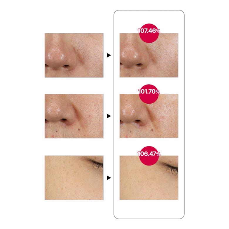 NEURADERM Core Time Ampoule 15ml*2ea