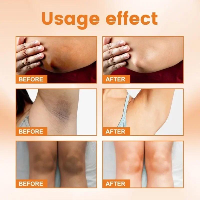 Crème Éclaircissante à la Vitamine C pour les Zones Sombres avec des Bienfaits Hydratants et Éclaircissants pour la Mélanine