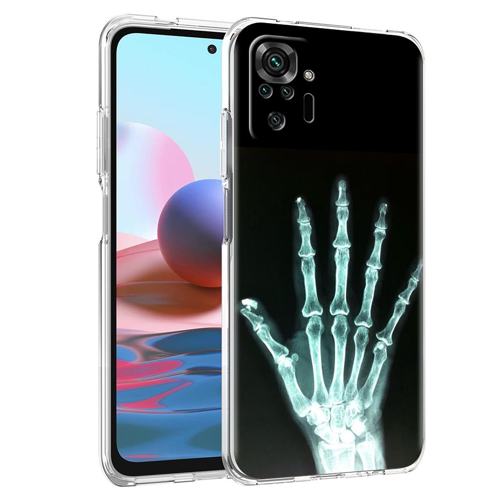 Transparent Phone Case for Redmi 14C 13C 10C 10 9 Note 13 12 11 K50 K40 Plus Pro 4G 5G Soft TPU Cover Autumu X Ray Hand Bones