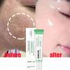 Salicylsyra Pore Shrinking Cream Snabb Eliminering Stora porer Ta bort Blackehead Strama Ansikte Smidig hudvårdsprodukt